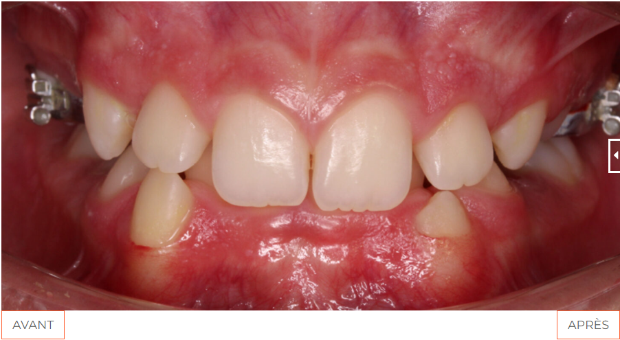 OBB Etudecas 01avant