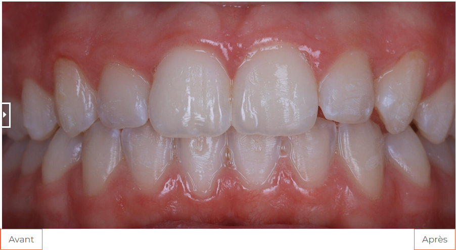 OBB Etudecas 02apres