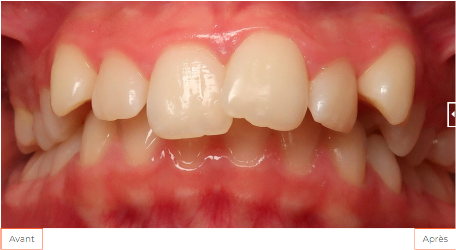 OBB Etudecas 02avant