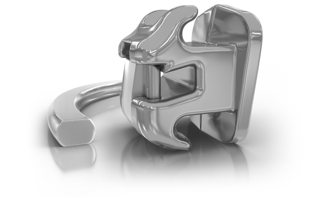 Les soins d’orthodontie ultima wire hero