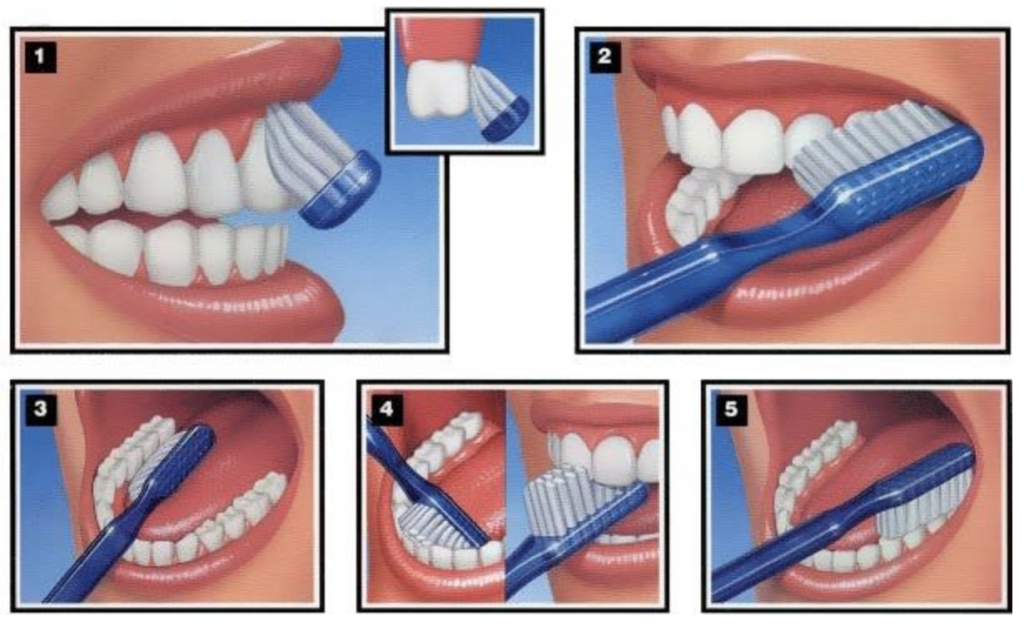 technique brossage dents