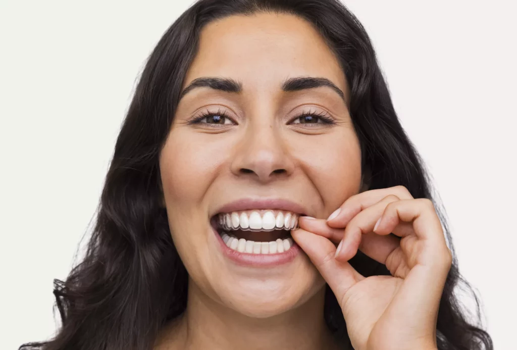 Les soins d’orthodontie traitement spark (photo).jpg